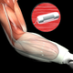 Illustration for article titled DARPAs Crazy Mind-Controlled Prosthetics Have Gotten Even Better